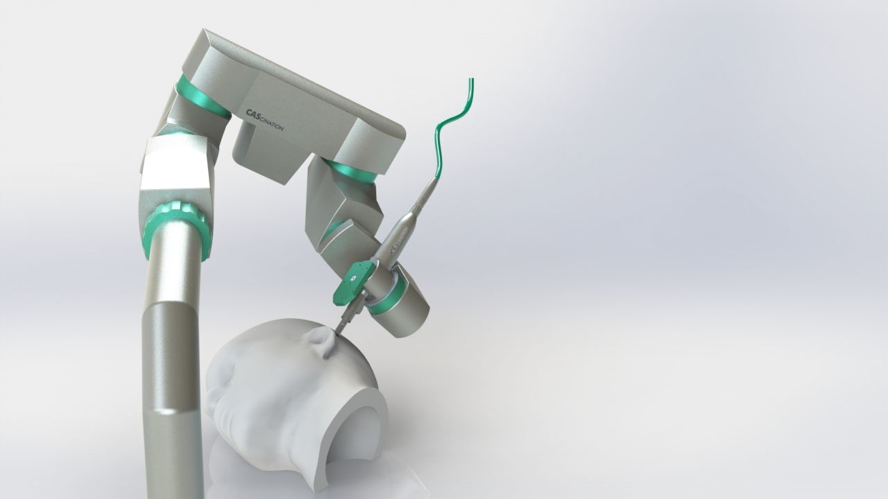Hearo: Operationsroboter für Cochlea-Implantate
